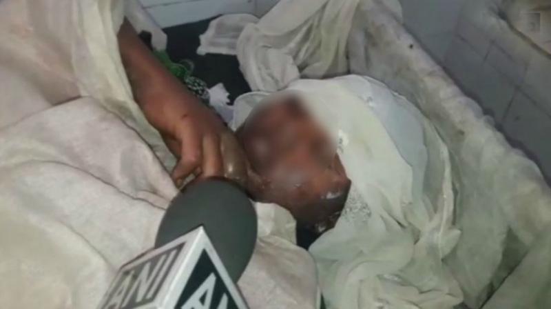 The girl was admitted to the district hospital and her condition was reported to be serious. (Photo: ANI | Twitter)
