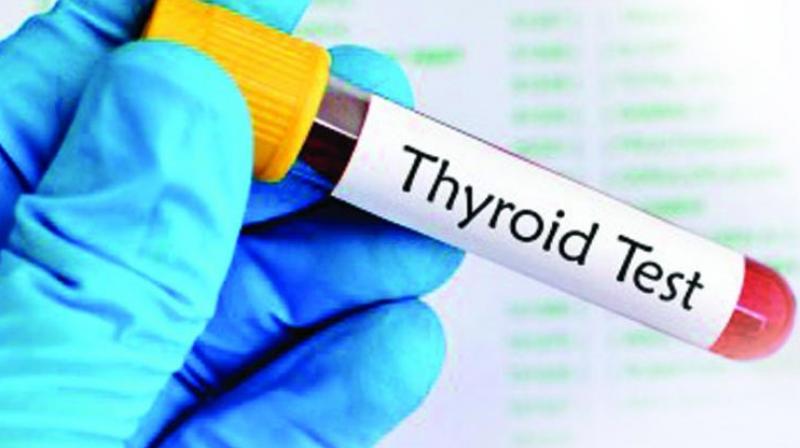 The increased incidence of thyroid disorder, which is largely found in women, is an auto-immune disorder where the gland stops producing the  hormones that regulate the metabolic functions of the body. This leads to unexplained weight gain, low appetite and fatigue.