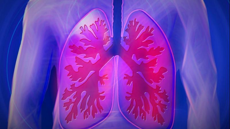 The negative impact of PM10 on pulmonary circulation was more pronounced in patients with obstructive sleep apnoea. (Photo: Pixabay)