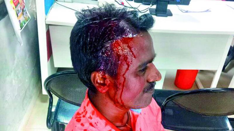 An injured protester sits at the Medchal police station.