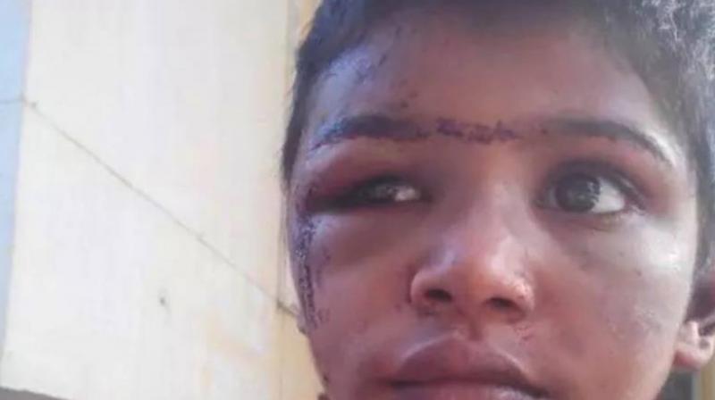 The child who was tortured in confinement by her employers (Photo: Facebook)