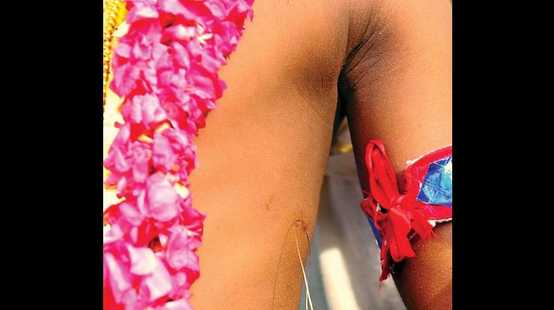Unfazed by the ban order, Chooral Muriyal ritual will be held at Chettikulangara temple by February 22. File pic of a childs midrib pierced with golden strings as part of Chooral Muriyal ritual.