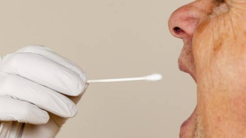 The saliva test will be presented at ASN Kidney Week 2016 (Photo: AFP)