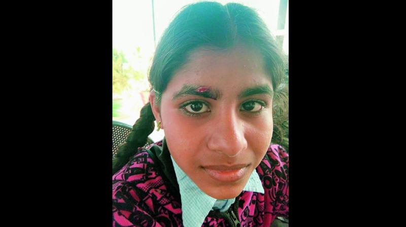 During the inquiry, the teacher told the police that she did not hit the girl intentionally and that the scale had slipped from her hand while she was teaching.