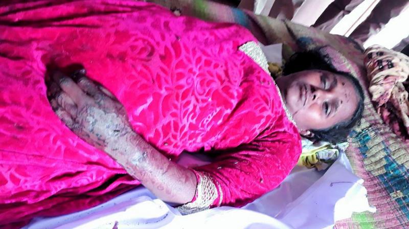 Fareeda Begum, whose right hand got severed in the mishap, before she succumbed to injuries.  (Photo:DC)