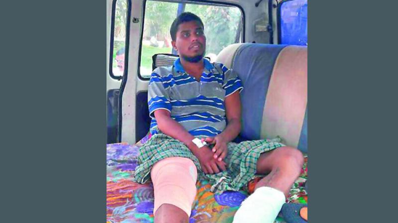 Kiran had an accident on November 2 and his right leg thighbone was severely damaged.
