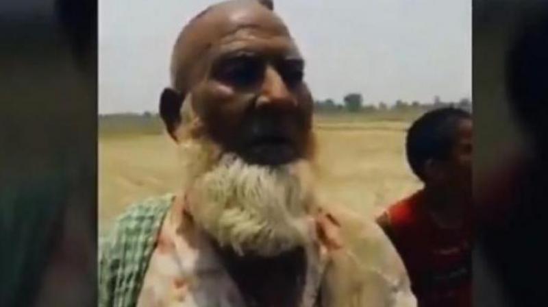 65-year-old Samiuddin survived the brutal attack on him by the mob from adjoining Bajheda Khurd village on June 18. (Photo: Screengrab | Twitter @imMAK02)