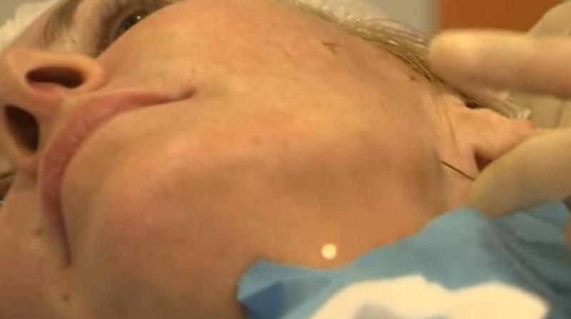 It has been referred to as the lunchtime facelift because of instant results (Photo: YouTube)