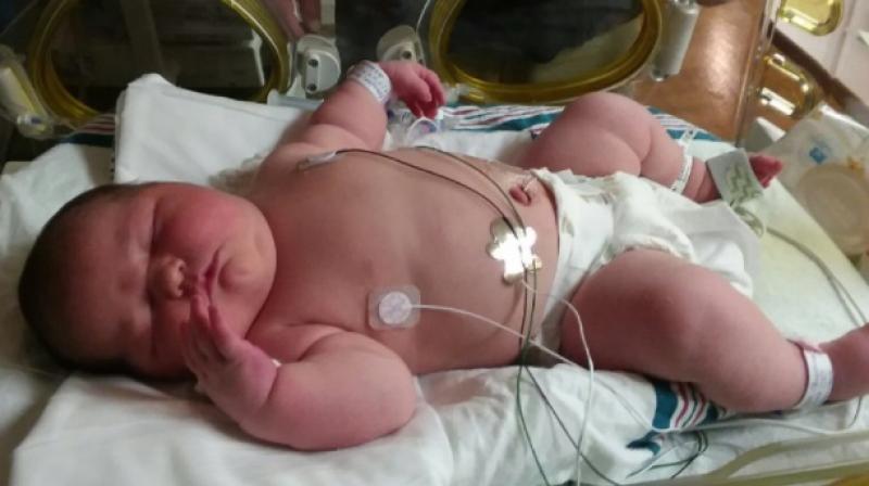 The mother gave birth to a healthy Carleigh Brooke Corbitt through C-section. (Photo: Twitter)