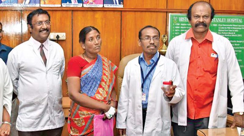 Dean Dr. Ponnumbala Namasivayam holds the  container with the dead cockroach found in a patients nose at Stanley Medical College and Hospital on Thursday. Patient Selvi, head of the ENT department M. N. Shankar and Resident Medical Officer Dr Ramesh look on.