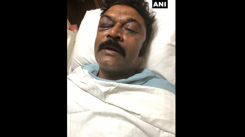 Sources at the private hospital where Anand Singh had been admitted had said Sunday he has a black eye and suffered blunt injuries. (Photo: ANI)