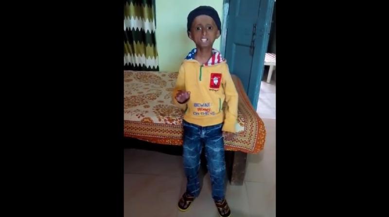 Doctor Girish Budhrani, the familys paediatrician says that despite the rare medical condition, Shreyash is an energetic and positive boy.  Shreyash wants to be a singer. (Photo: Youtube screengrab)