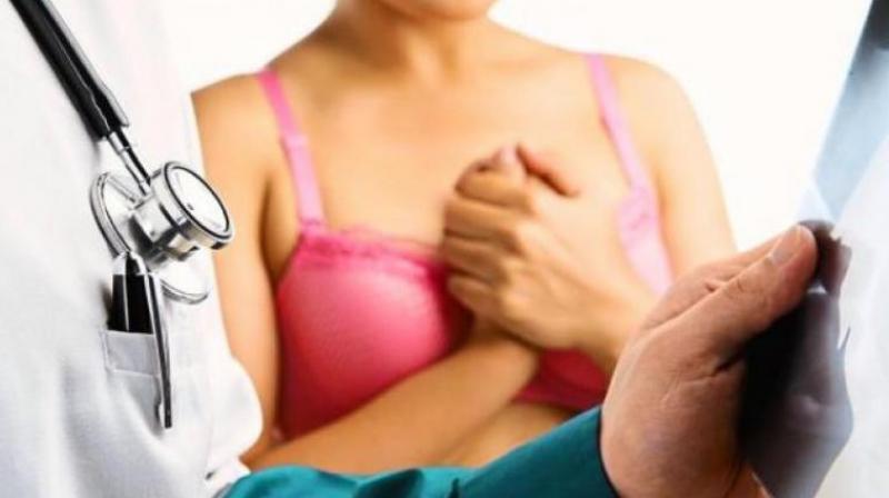 Breast cancer on the rise in India. (Photo: AFP)