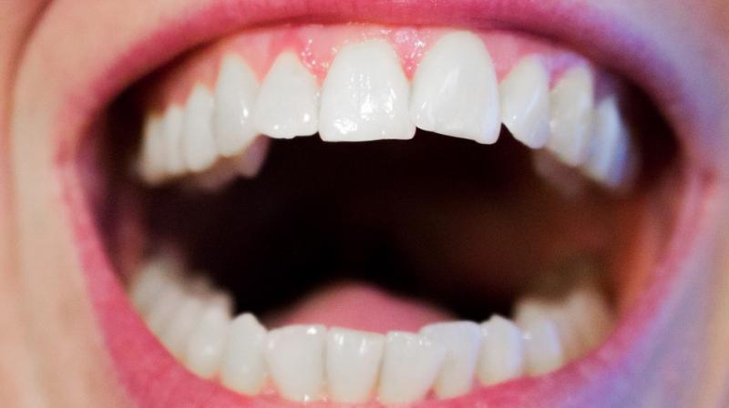 Scientists develop unique patch to treat oral ulcers . (Photo: Pixabay)
