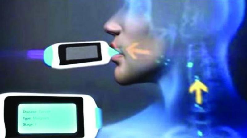 Scientists are working on an  electronic nose , which can detect diseases early by analysing the smell of a patients breath.