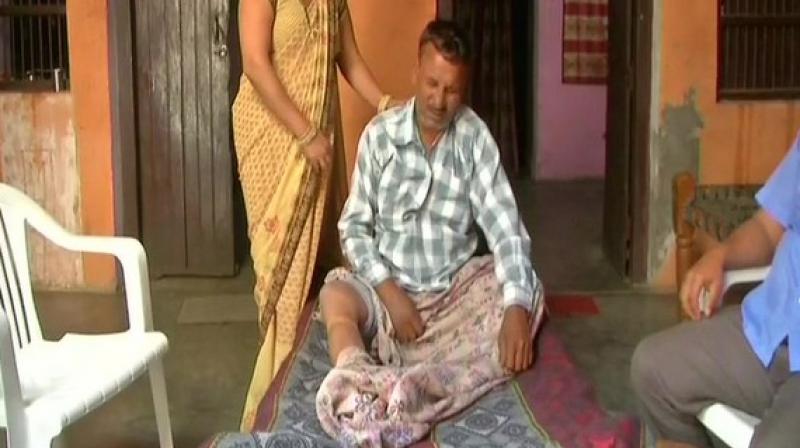 The negligence happened as the doctor, a senior resident at Sushruta Trauma Centre in Civil Lines area, mistook the patient with head injury for another patient admitted there with a fractured leg. (Photo: ANI)