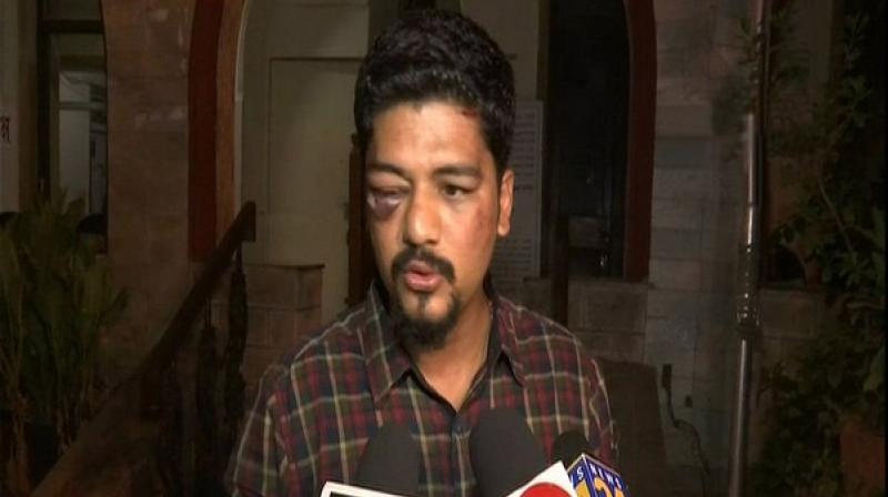 The incident, as narrated by journalist Herman Gomes, happened outside his house around 1:30 am on Saturday. Gomes said that the miscreants were waiting outside his home. (Photo: ANI)