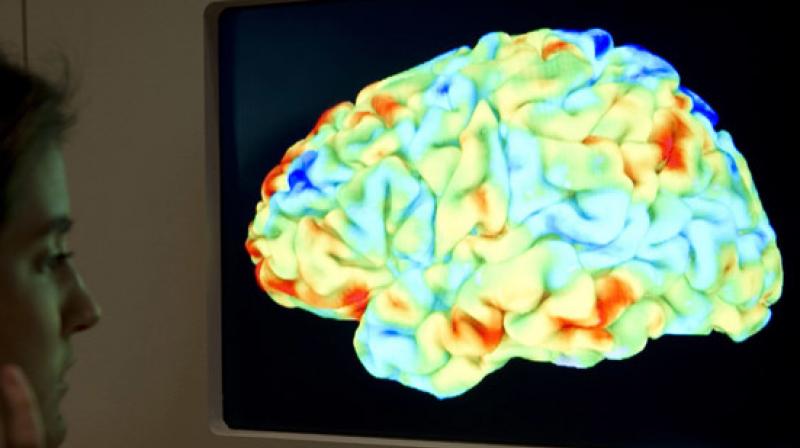 Some individuals develop brain networks that favor intelligent behaviors or more challenging cognitive tasks (Photo: AFP)