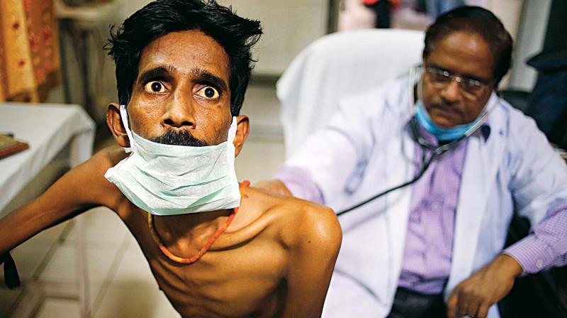 World Tuberculosis Day: Eliminating TB an uphill task