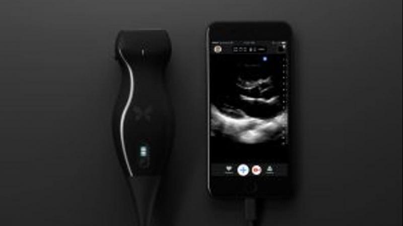 Scientists have developed a novel smartphone-based portable ultrasound machine that can help detect cancer easily at home. (Photo: Facebook/ButterflyNetworkInc.)