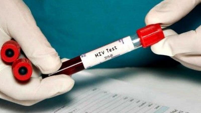 Young men in racial/ethnic minorities, or who have sex with men, may be at great risk for HIV infection. (Photo: AP)