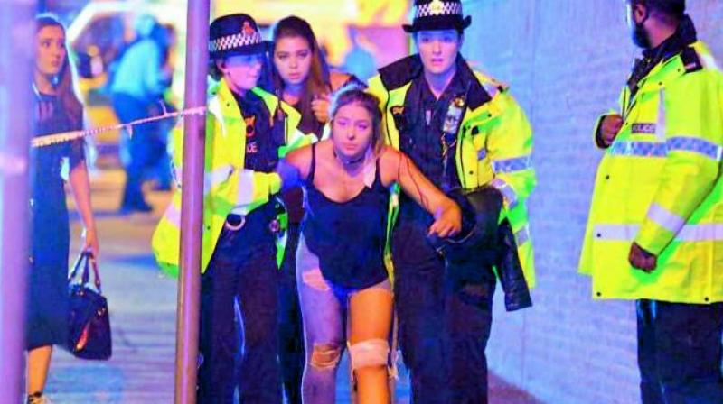 An injured fan being escorted from the scene of a terrorist attack during a pop concert by US star Ariana Grande in Manchester, northwest England. (Photo: AP)