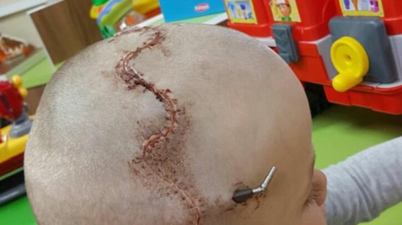 The child was at risk of blindness and brain damage (Photo: YouTube)