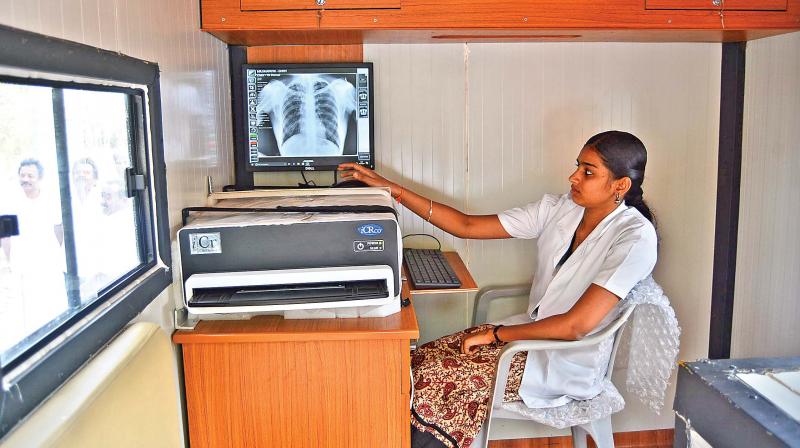 A technician shows the recently launched digital X-Ray machine to detect TB. (Photo: DC)