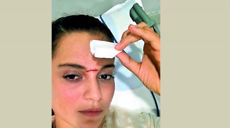 Kangana suffered a deep cut while filming a sword fighting scene (Pic credits: Pinkvilla)
