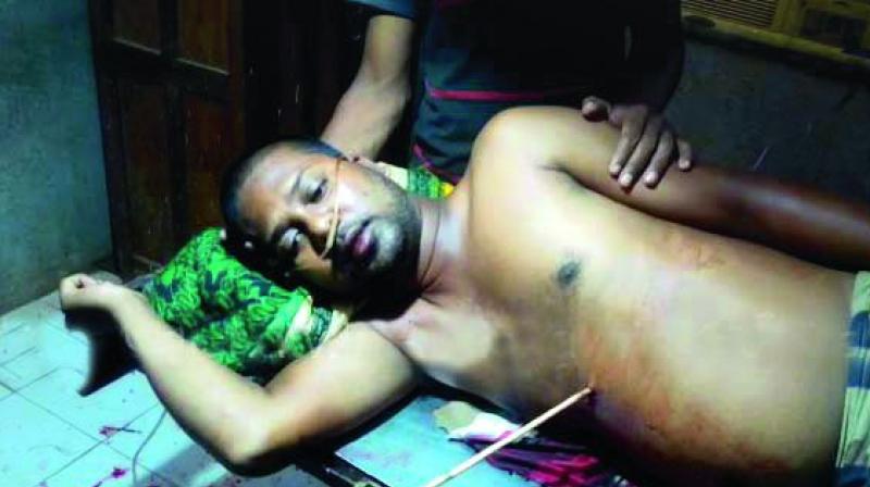 Ajay Mahant lies with the arrow pierced in his stomach on Friday	(Photo: DC)