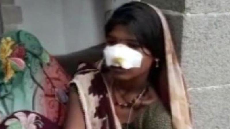 Attackers slit off womans nose in Madhya Pradesh when she denied doing household and field work. (Photo: ANI)
