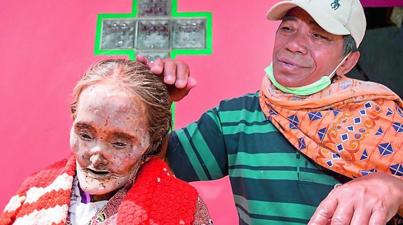 A Toraja tribesman with his mothers corpse.