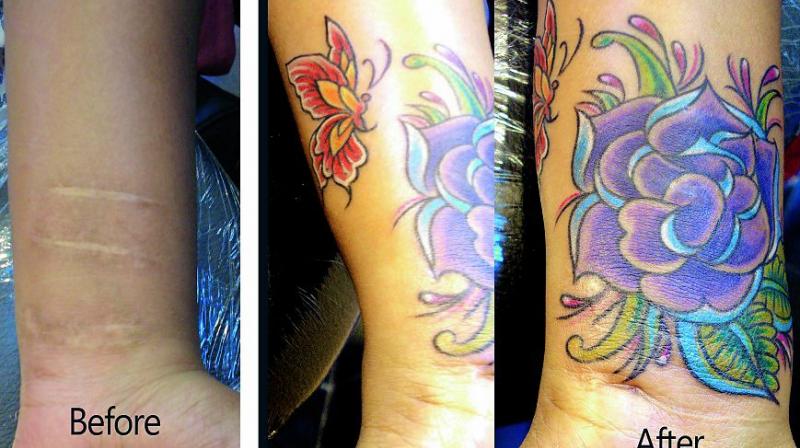 Tattoos of feathers, fish, or floral designs are suggested for scar cover-ups since they have more details which can hide the injuries.