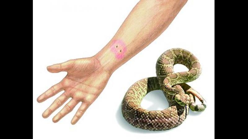 Approximately, 4,21,000 snakebites occur around the world every year.