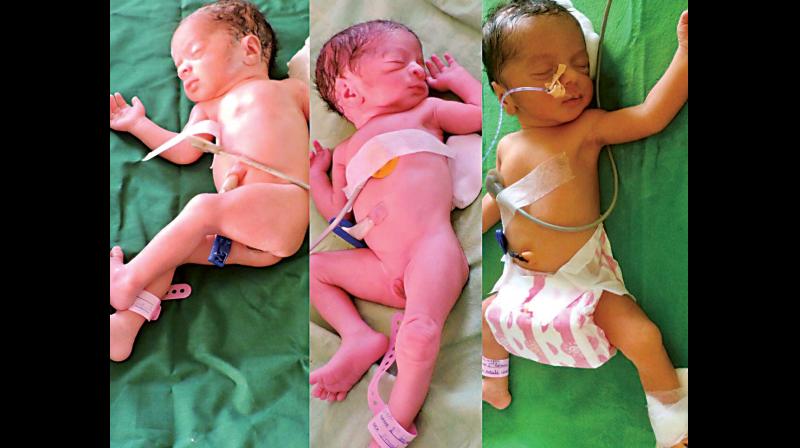 All three babies - a boy and two girls - and their mother, 26 year- old Roopa,  are all doing well.