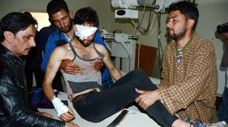 A student, injured during a clash between protesters and security forces at Degree College in Pulwama, being treated at SMHS Hospital in Srinagar on Saturday. (Photo: PTI)