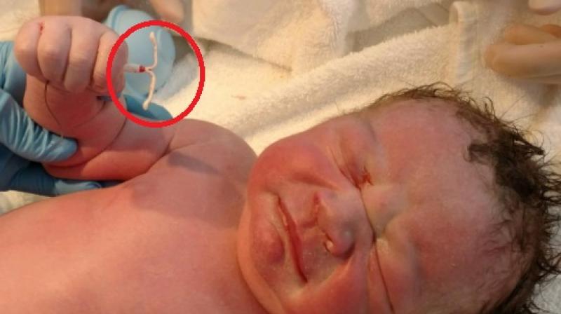 A baby was born holding moms contraceptive device and internet is freaking out