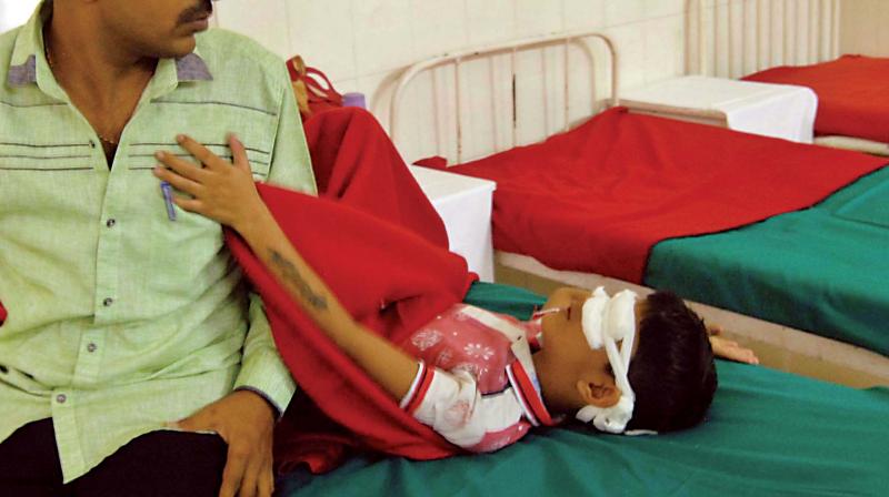 A boy undergoing treatment for cracker injuries at Minto Eye hospital in Bengaluru on Thursday. (Photo: KPN)