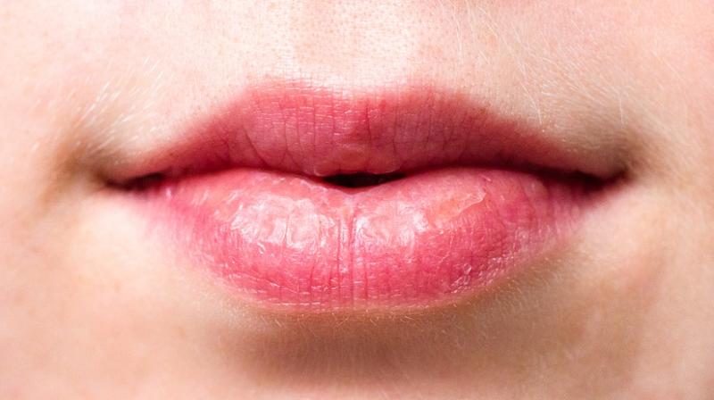 Lips not only symbolize ones beauty but also it talks about ones healthy appearance.