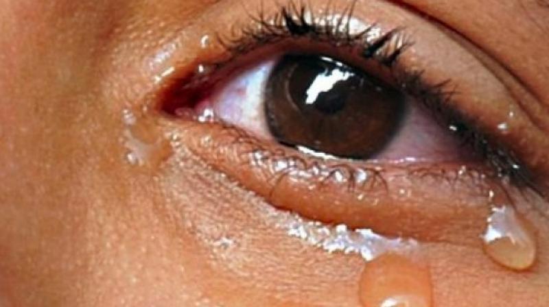 Biomarkers in tears help detect breast cancer (Photo: AFP)