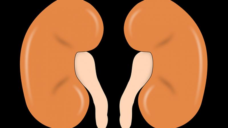 The mini-kidneys lack a large artery, and without that the organs function will only be a fraction of normal. (Photo: Pixabay)