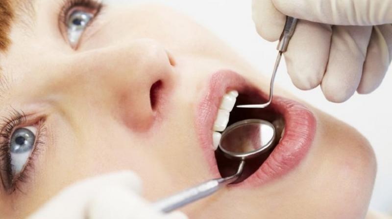 More research is needed to find out exactly how gum disease may promote cancer (Photo: AFP)