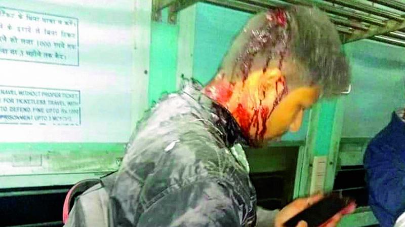 An injured person after an explosion in an intercity train at Udalguri, Assam, Saturday. (PTI)