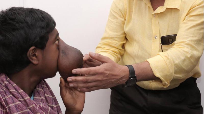 Manikandan with doctor before surgery. (Photo: Facebook /Amrita Institute of Medical Sciences & Research Center)