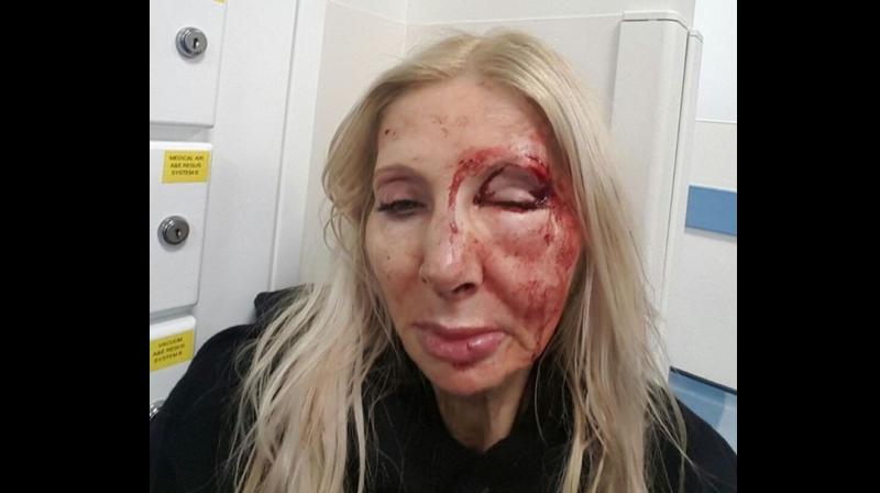 The attack left her with severe facial injuries. (Photo: Twitter)