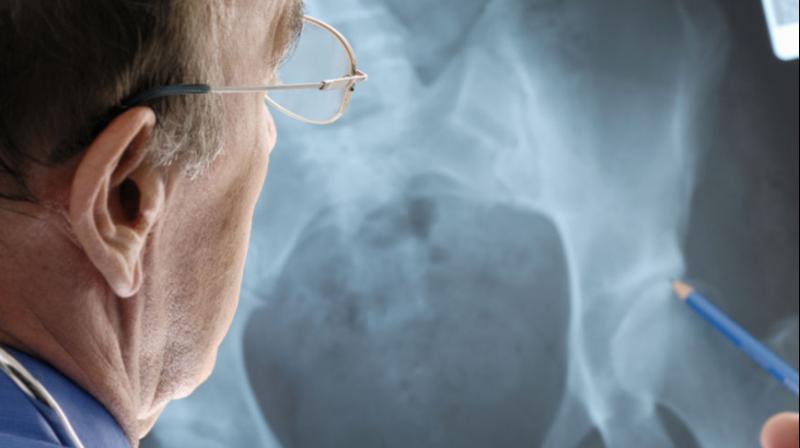 The research paves the way for treatments to preserve long-term skeletal health (Photo: AFP)