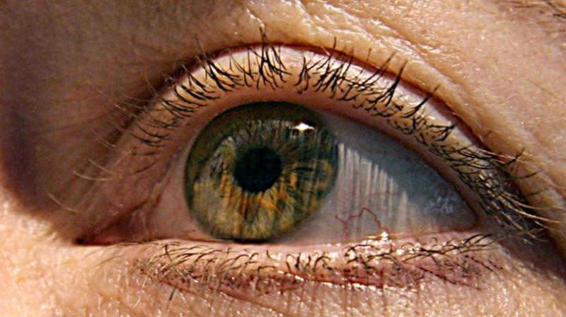 This case brings to light the longest time between lens migration and eyelid swelling caused by it (Photo: AFP)