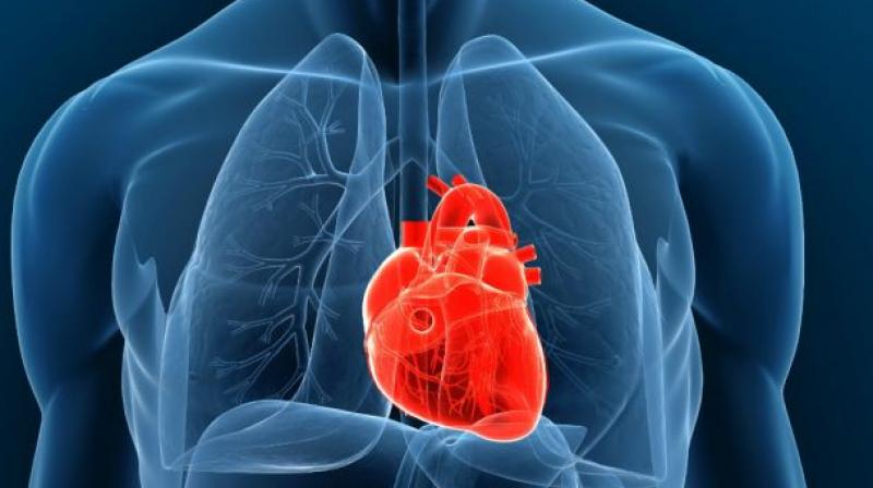 ECMO is a technique of providing both cardiac and respiratory support to persons whose heart and lungs are unable to provide an adequate amount of gas exchange to sustain life. (Photo: AFP/Representational Image)