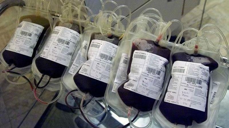 Blood transfusions have been deemed as one of the safest life-saving procedures for a person has undergone a major surgery or been in a serious accident. (Photo: AP)