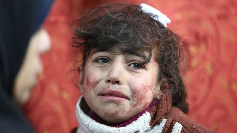 International attention has been focused in recent weeks mainly on the plight of civilians in eastern Ghouta, where the United Nations believes 400,000 people have been trapped under punishing bombardment, deprived of food and medicine. (Photo: Representational/ AFP)